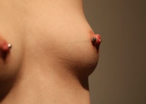 Piercingstudio Hamburg , Tattoostudio Hamburg , Hakuna Ma Tattoo , Schlupfwarzen , Hohlwarzen , Schlupfwarzen Piercing nachher