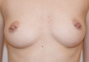 Piercingstudio Hamburg , Tattoostudio Hamburg , Hakuna Ma Tattoo , Tattoos , Piercings , Nippel Piercing