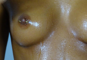 Piercingstudio Hamburg , Tattoostudio Hamburg , Hakuna Ma Tattoo , Tattoos , Piercings , Nippel Piercing