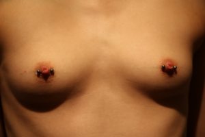 Piercingstudio Hamburg , Tattoostudio Hamburg , Hakuna Ma Tattoo , Schlupfwarzen , Hohlwarzen , Schlupfwarzen Piercing nachher